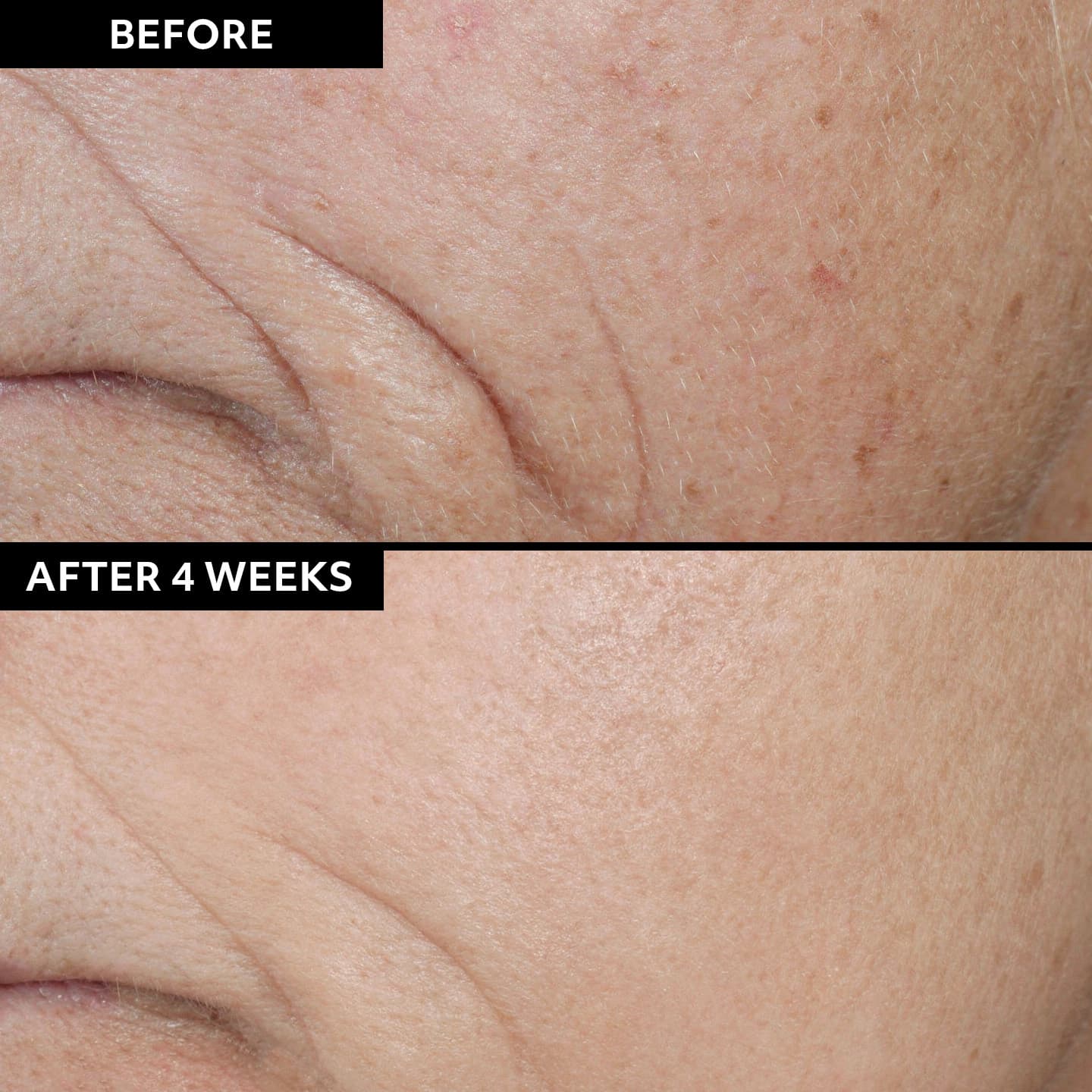 Before and after using Vitamin C Skin Refiner